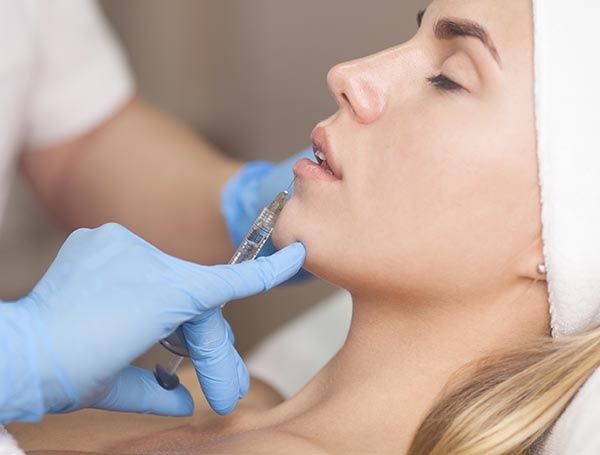 Filler, Studio Lubelli, Medicina Estetica Sassari