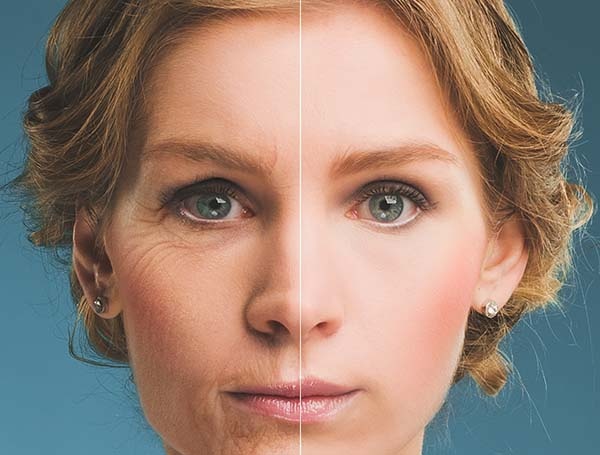 fotoringiovanimento, Studio Lubelli, Medicina Estetica Sassari