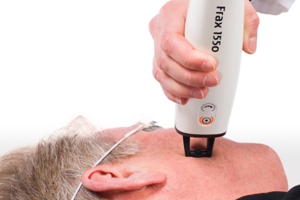 Fotoringiovanimento dei tessuti con luce pulsata, Studio Lubelli, Medicina Estetica Sassari